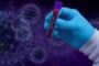 Ученые определили главный фактор выживаемости при коронавирусе