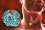Двуликий рак. Какие секреты хранит в себе щитовидка?