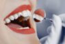 Спасти ситуацию. Как можно восстановить сломанный зуб?